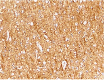 ATR Antibody
