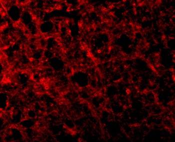 ATR Antibody