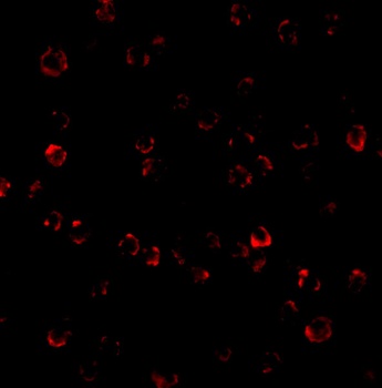 ATR Antibody