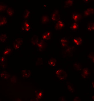 ATP2C2 Antibody