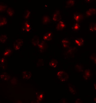 ATP2C2 Antibody