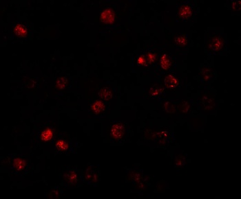 ATP11B Antibody