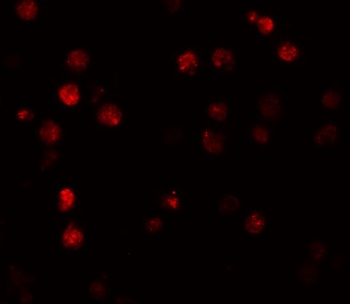 ATP11A Antibody