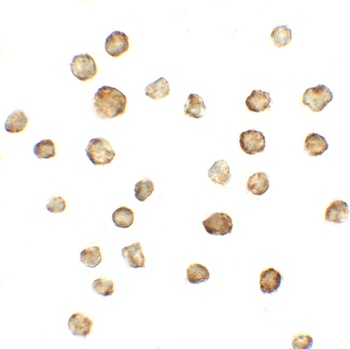 ATMIN Antibody