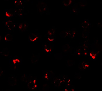 ATMIN Antibody