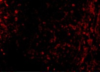 ATM Antibody