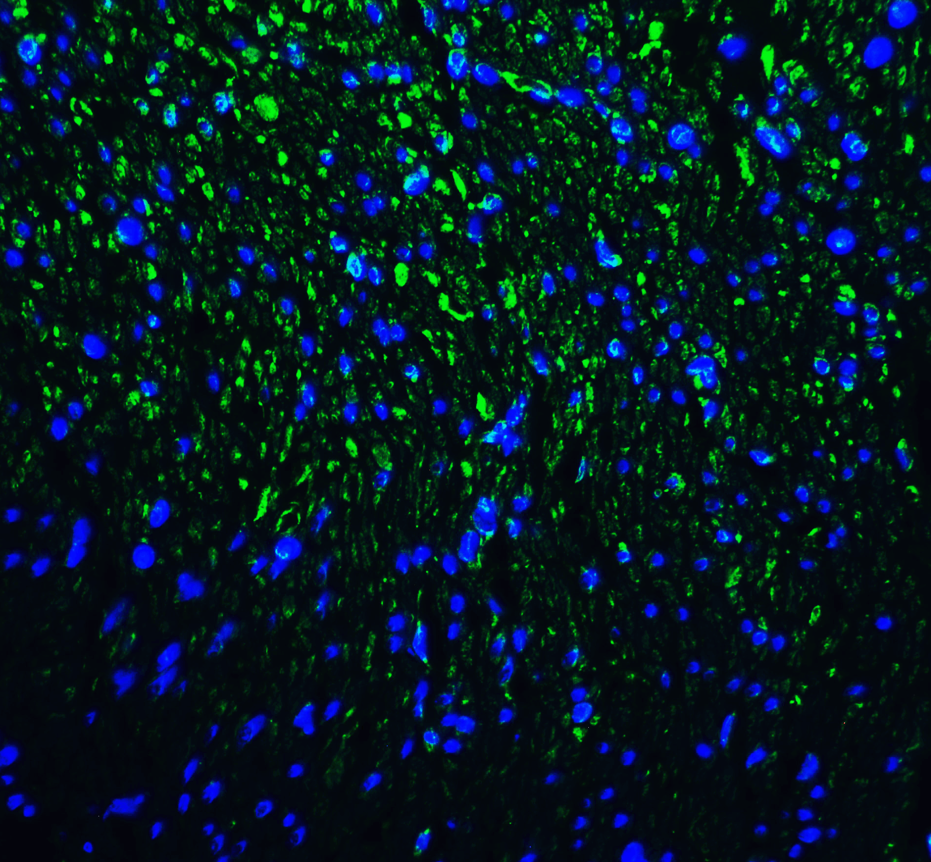 HAVCR2 Antibody