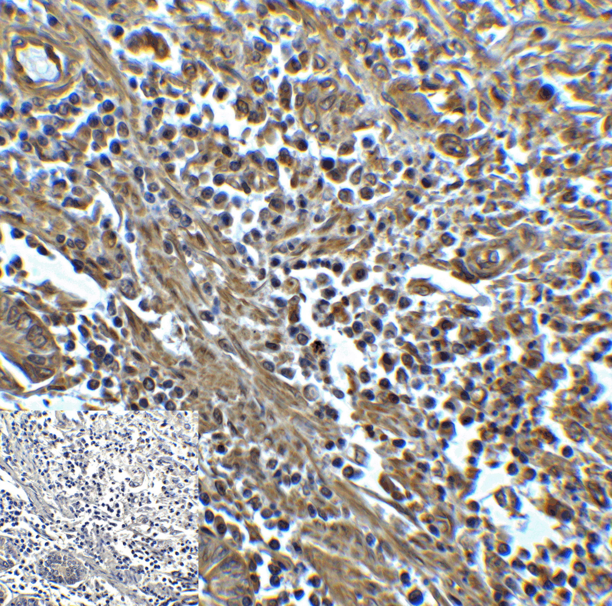 HAVCR2 Antibody