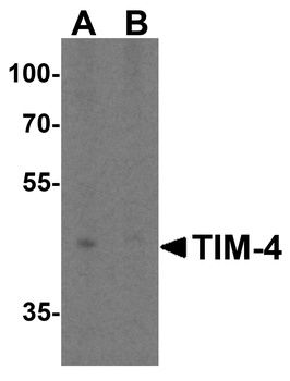 TIM-4 Antibody