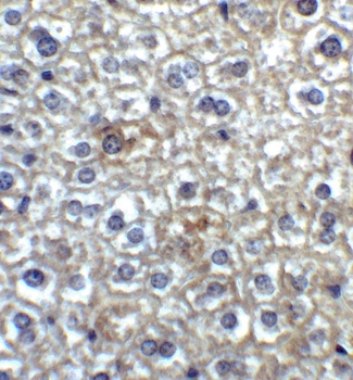 TIMD4 Antibody