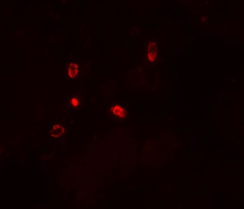 ATG4D Antibody