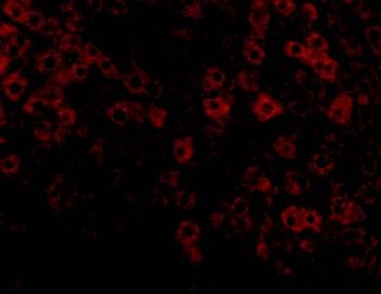 TIP47 Antibody