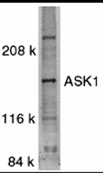ASK1 Antibody