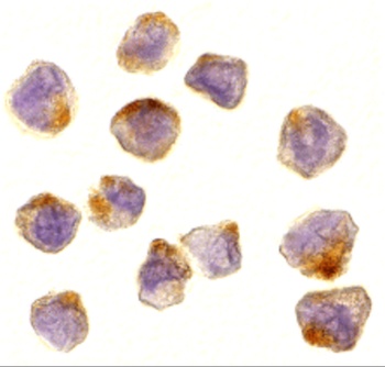 ASK1 Antibody