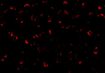 ASK1 Antibody