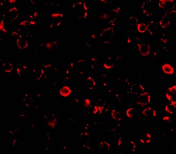 TLR3 Antibody