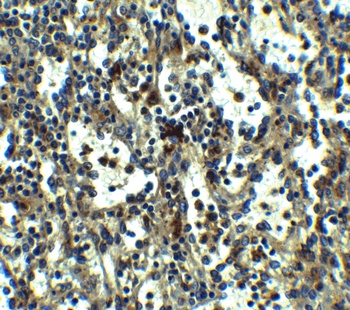 TLR3 Antibody