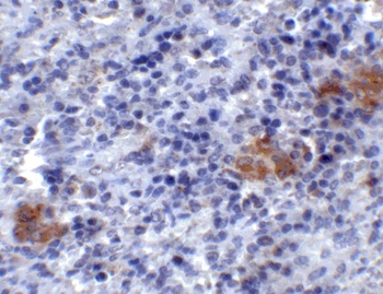 TLR3 Antibody