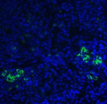 TLR3 Antibody