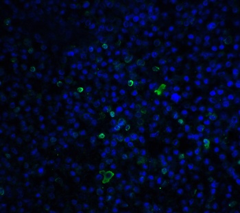 TLR3 Antibody