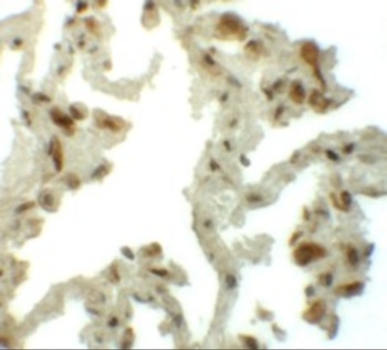 TM4SF1 Antibody