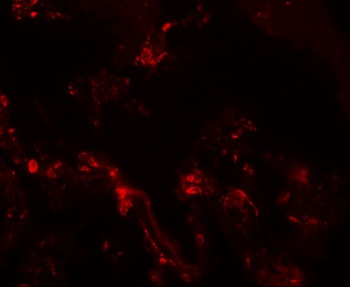 TM4SF1 Antibody