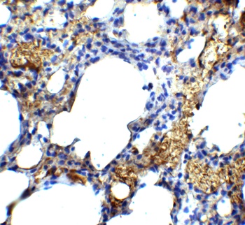 TM4SF1 Antibody