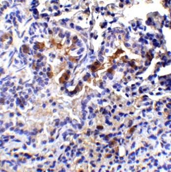 TM4SF1 Antibody