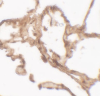 ARSB Antibody
