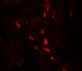 ARSB Antibody