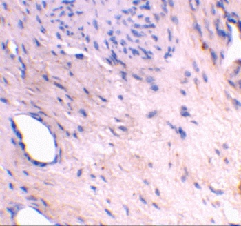 ARMER Antibody