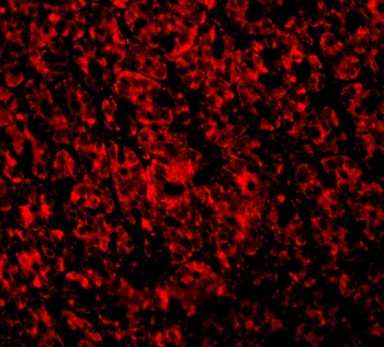 ARMER Antibody