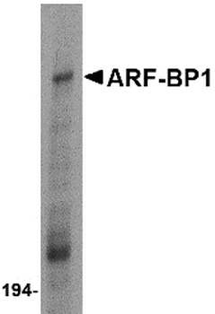 HUWE1 Antibody