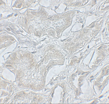 ARF6 Antibody