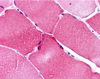 ARC Antibody