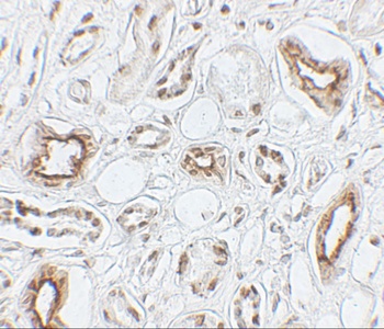 AQP2 Antibody