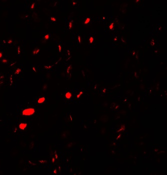 AQP2 Antibody