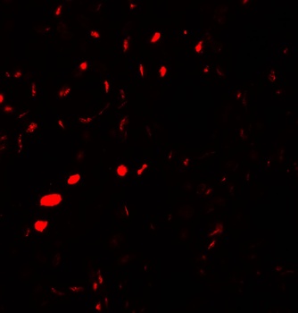 AQP2 Antibody