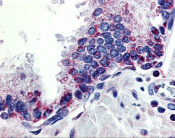 TNFSF13 Antibody