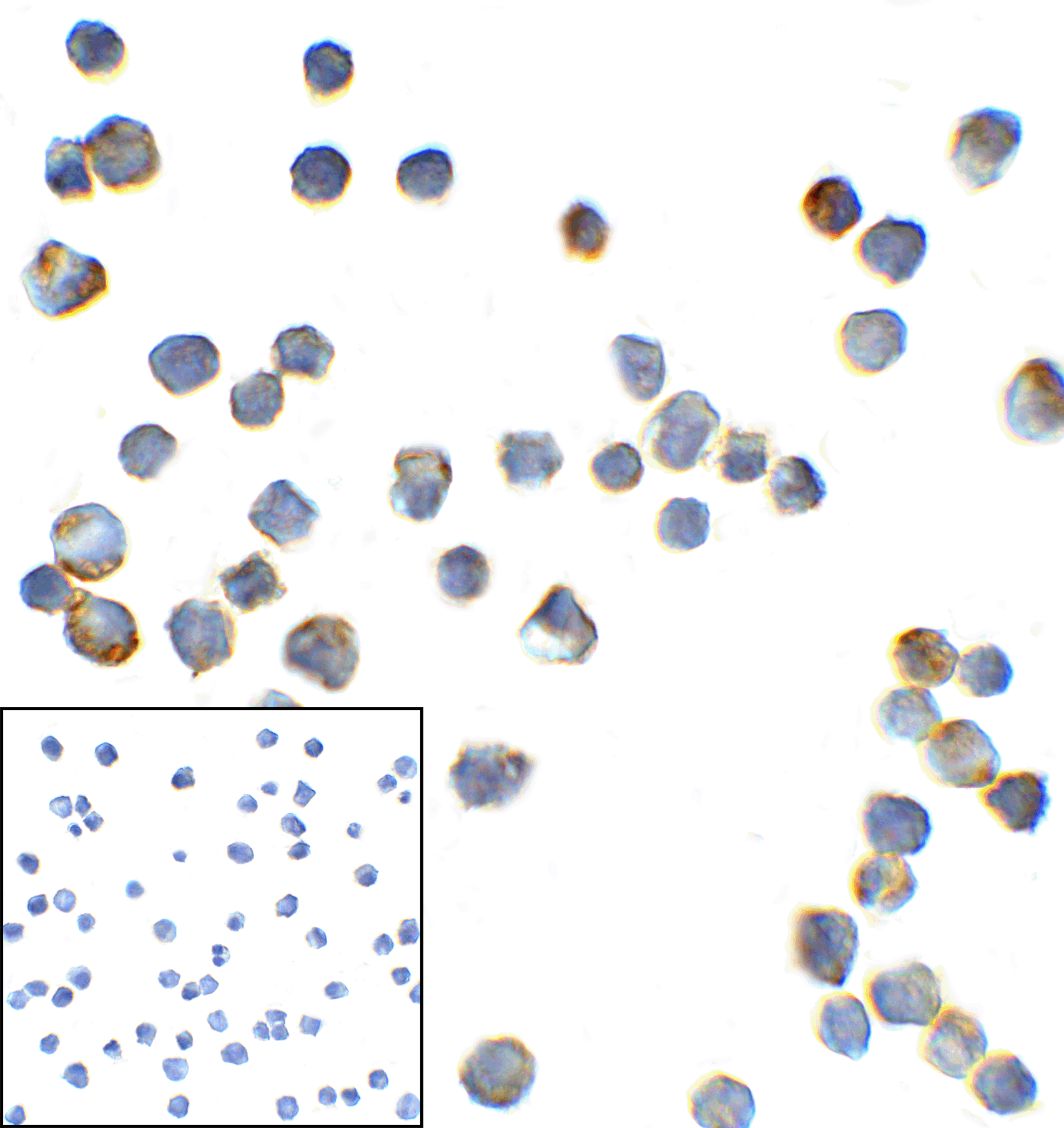 TMIGD2 Antibody