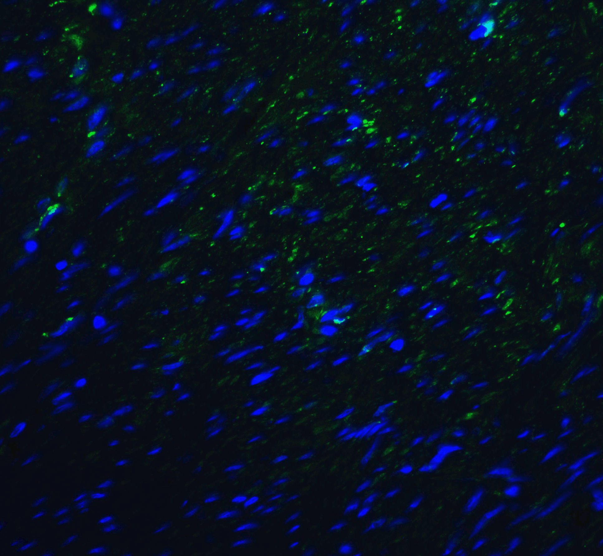 TMIGD2 Antibody [8A1]