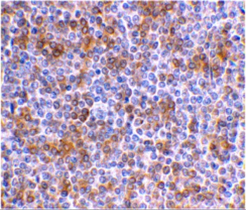 APOBEC3G Antibody