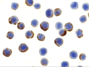 ATG7 Antibody