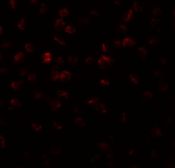 APC11 Antibody