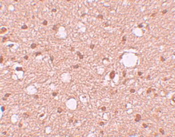 APBA2 Antibody