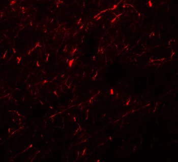 APBA1 Antibody