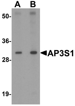 AP3S1 Antibody