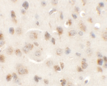 AP3M1 Antibody