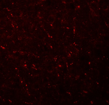 AP3M1 Antibody