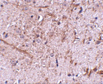 TOMM70A Antibody